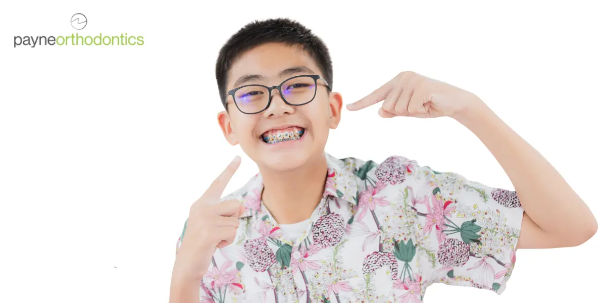 Benefits of Choosing Metal Braces for Kids