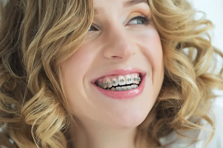 Modern metal braces