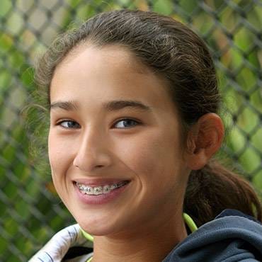 Common orthodontic problems